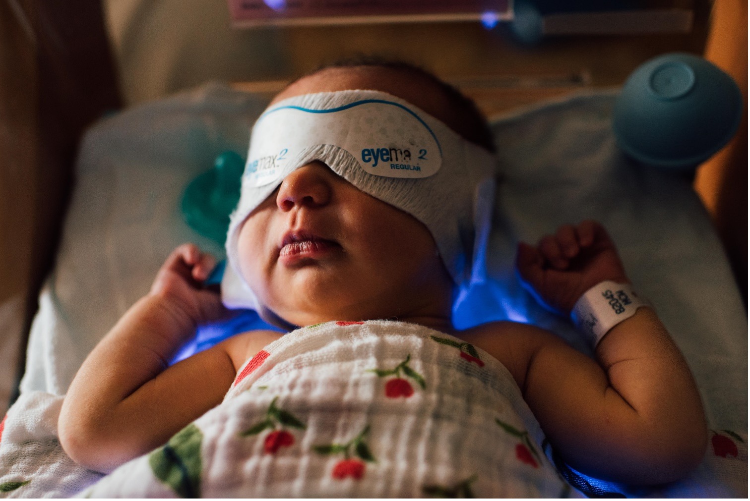 Home Phototherapy a collaboration between the Neonatal Clinic and the